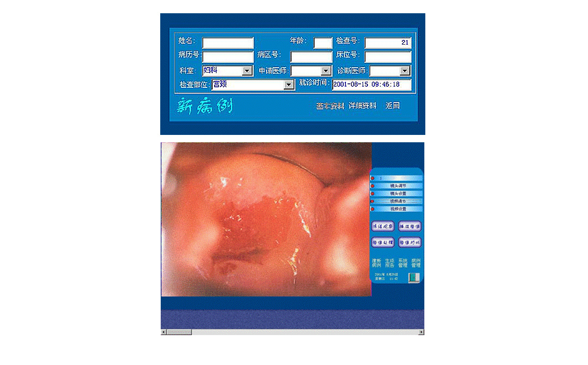 如何使用數(shù)碼電子陰道鏡? 如何使用數(shù)碼電子陰道鏡?