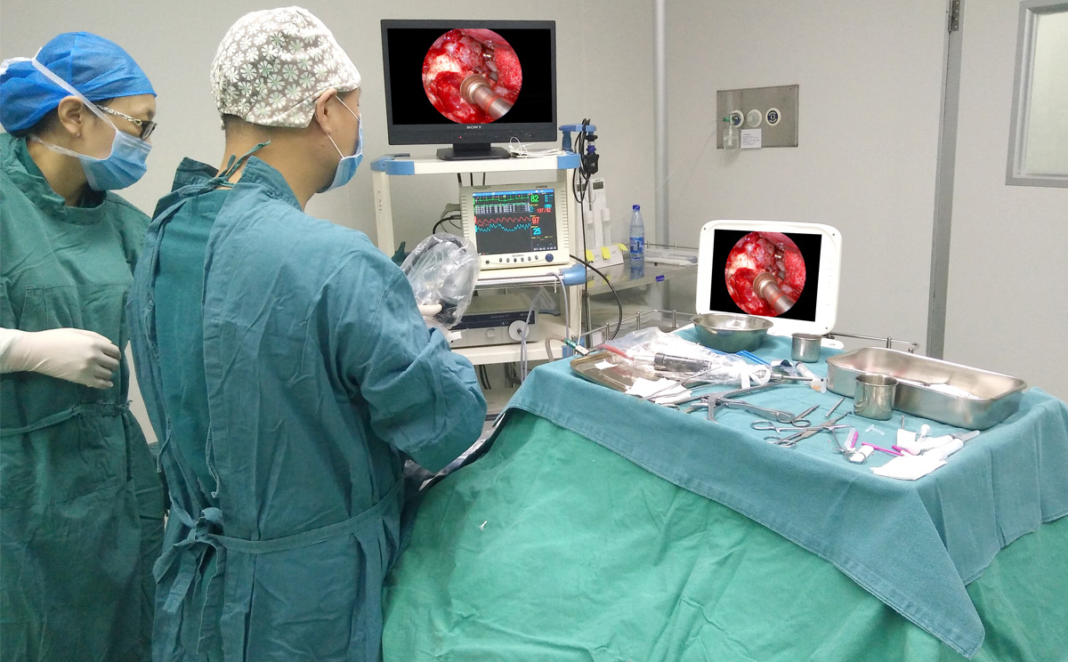 內窺鏡攝像機的工作原理 內窺鏡攝像機的工作原理