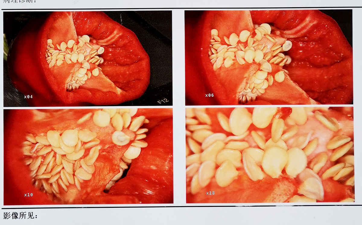 【益柯達】高清數(shù)碼電子陰道鏡新升級 【益柯達】高清數(shù)碼電子陰道鏡新升級
