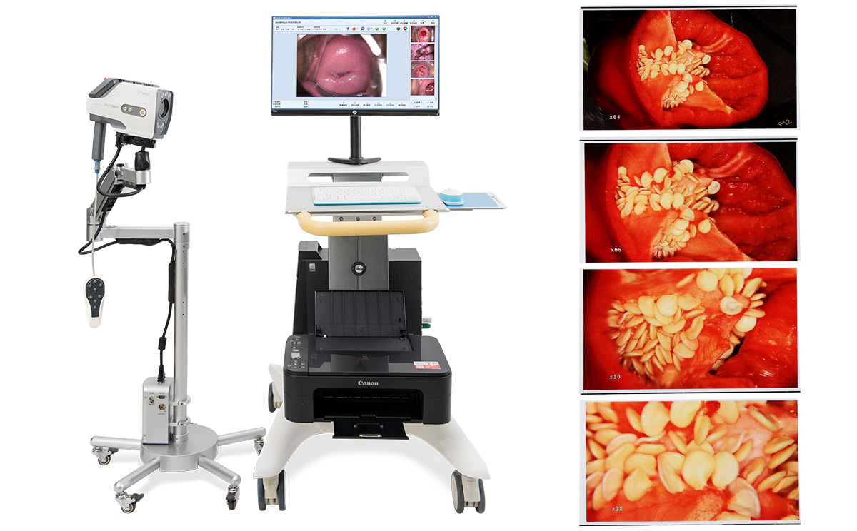 電子陰道鏡工作站的特點 電子陰道鏡工作站的特點