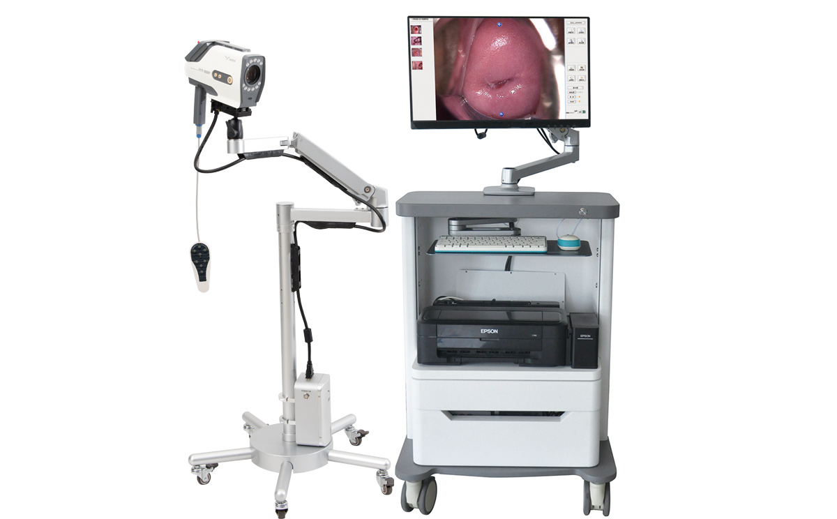 益柯達新款數(shù)碼電子陰道鏡 益柯達新款數(shù)碼電子陰道鏡