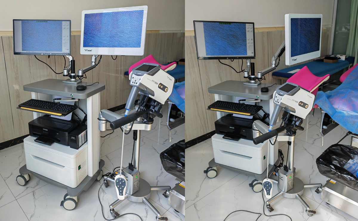 益柯達(dá)數(shù)碼電子陰道鏡(雙屏)裝機(jī) 益柯達(dá)數(shù)碼電子陰道鏡(雙屏)裝機(jī)