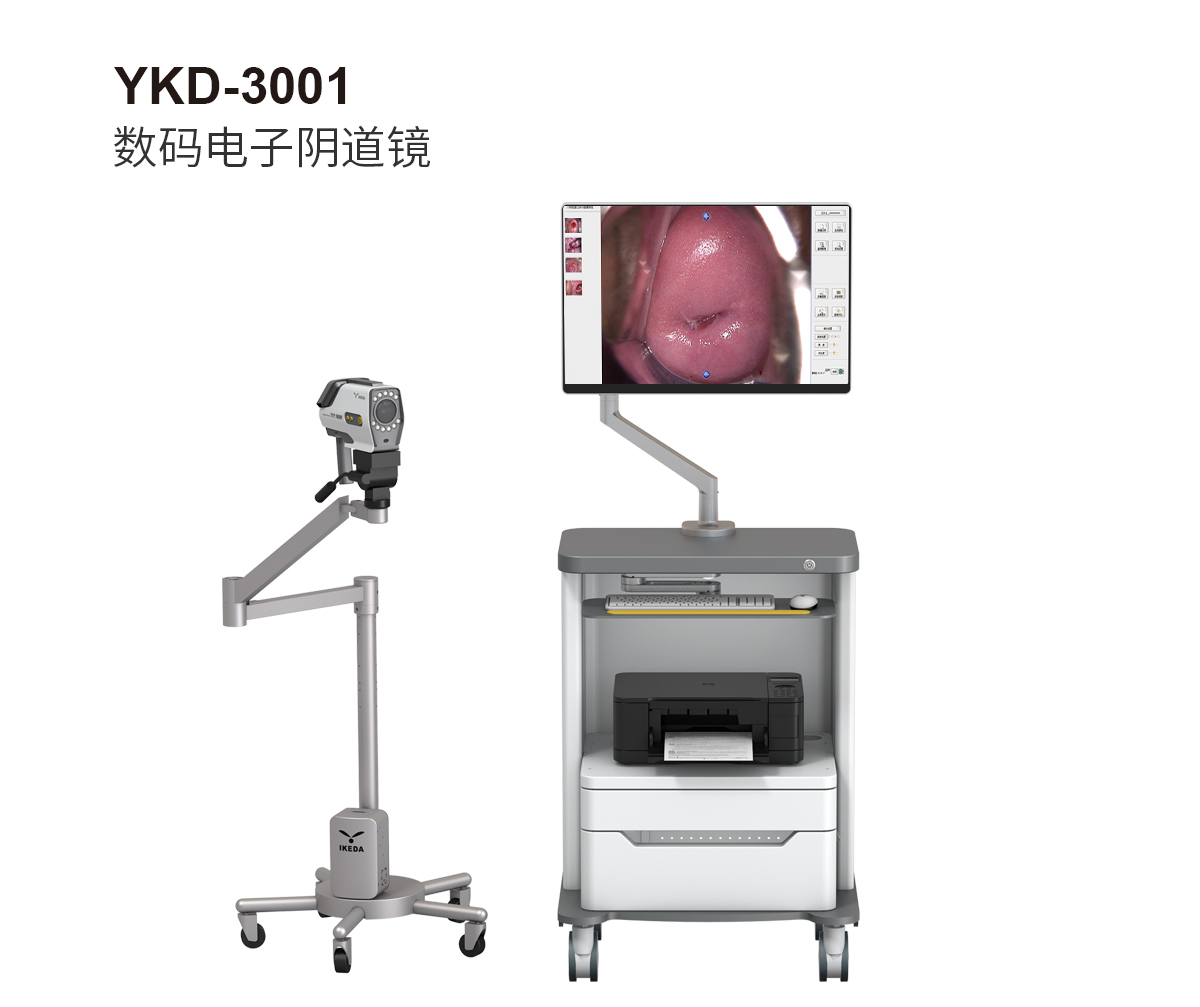 YKD-3001 數(shù)碼電子陰道鏡 YKD-3001 數(shù)碼電子陰道鏡