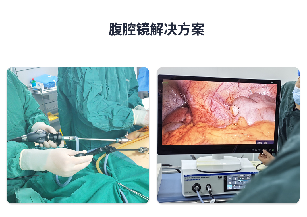 高清腹腔鏡系統(tǒng) 高清腹腔鏡系統(tǒng)