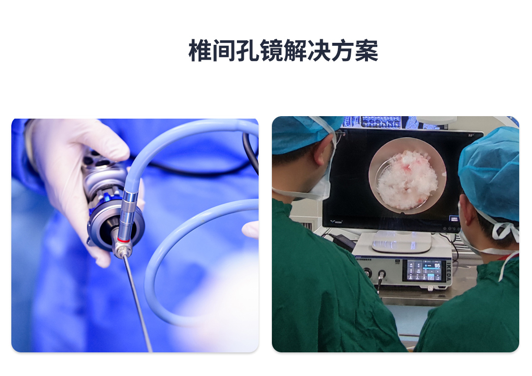 椎間孔鏡 椎間孔鏡