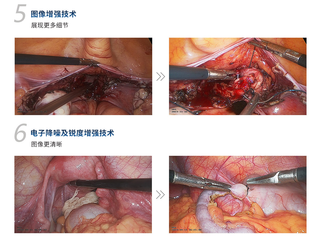 4K醫(yī)用內(nèi)窺鏡攝像系統(tǒng) YKD-9211 4K醫(yī)用內(nèi)窺鏡攝像系統(tǒng) YKD-9211