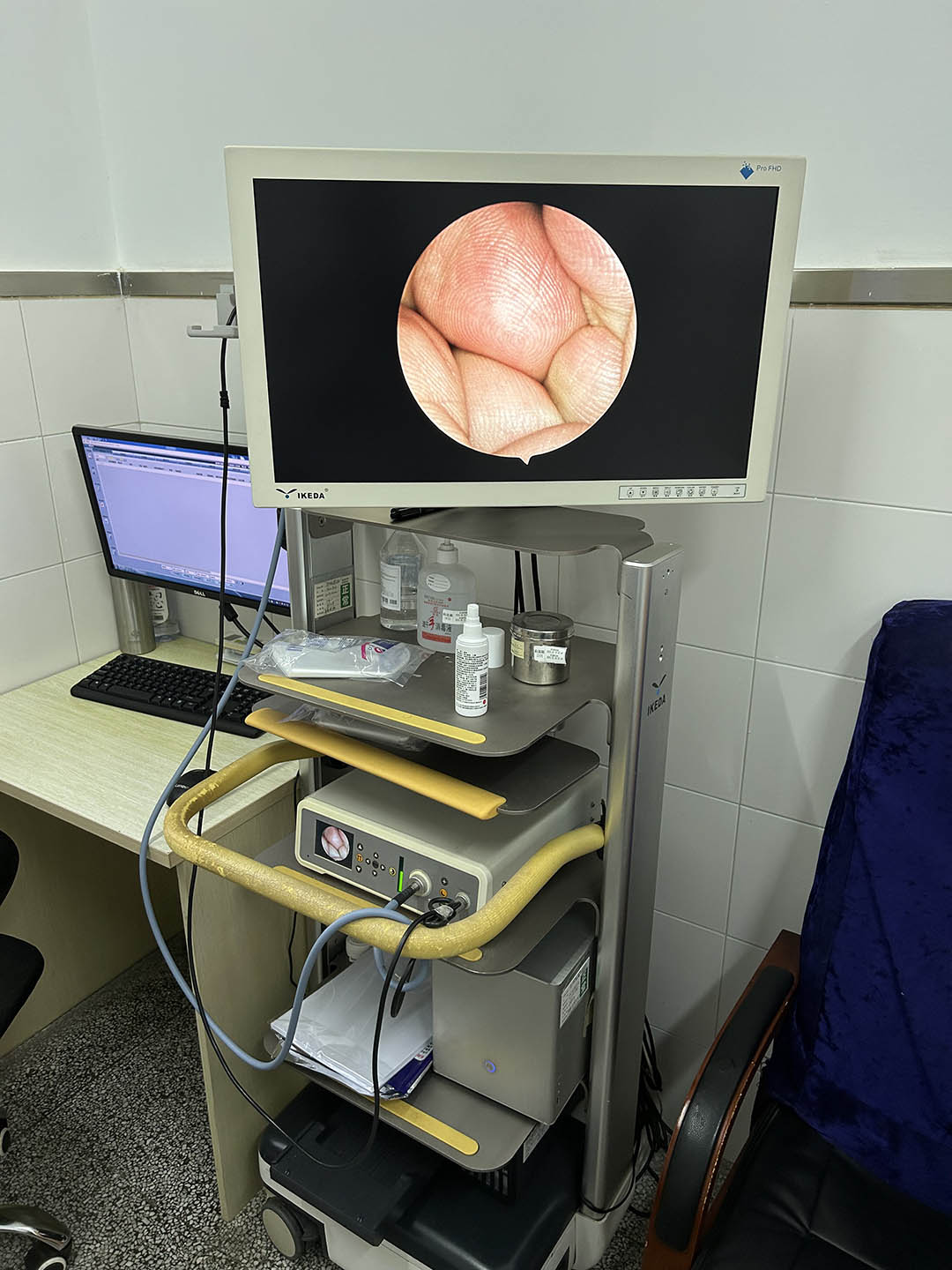 醫(yī)用內(nèi)窺鏡攝像系統(tǒng)