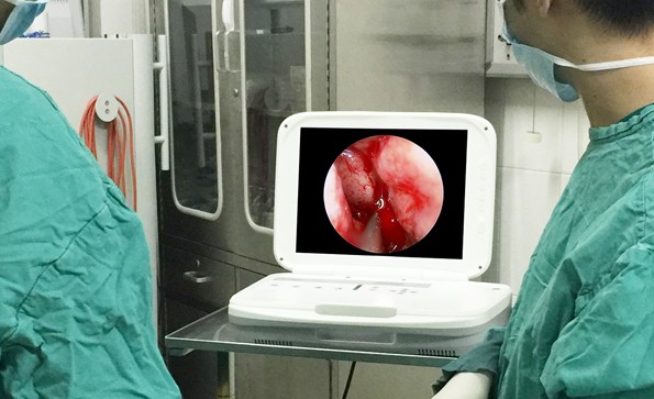 耳鼻喉科內(nèi)窺鏡檢查痛嗎？